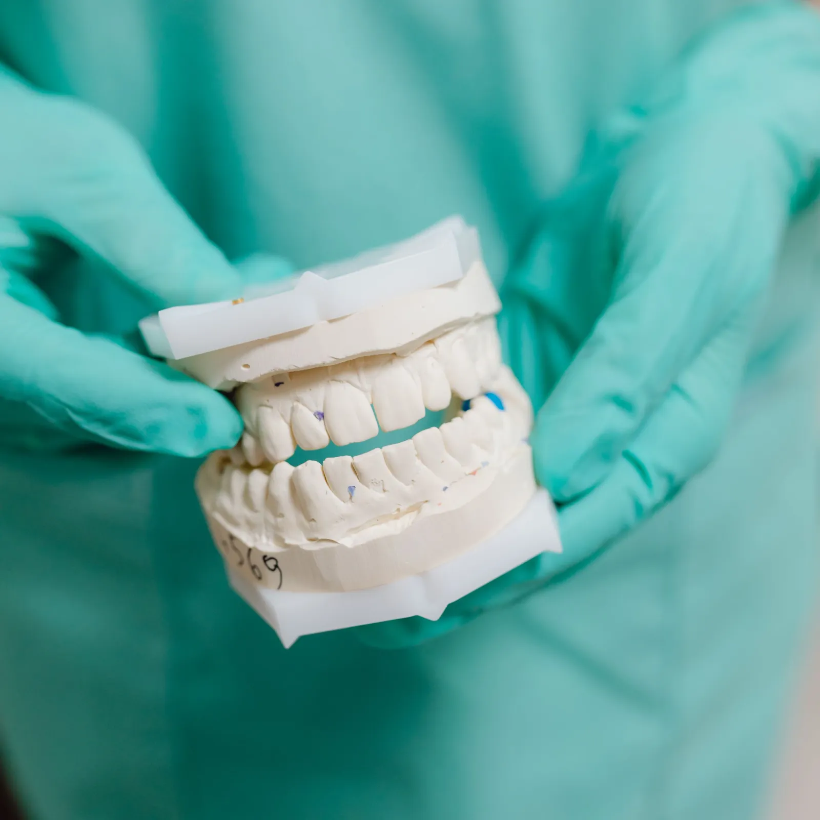 Gloved hands holding a plaster cast of upper and lower teeth